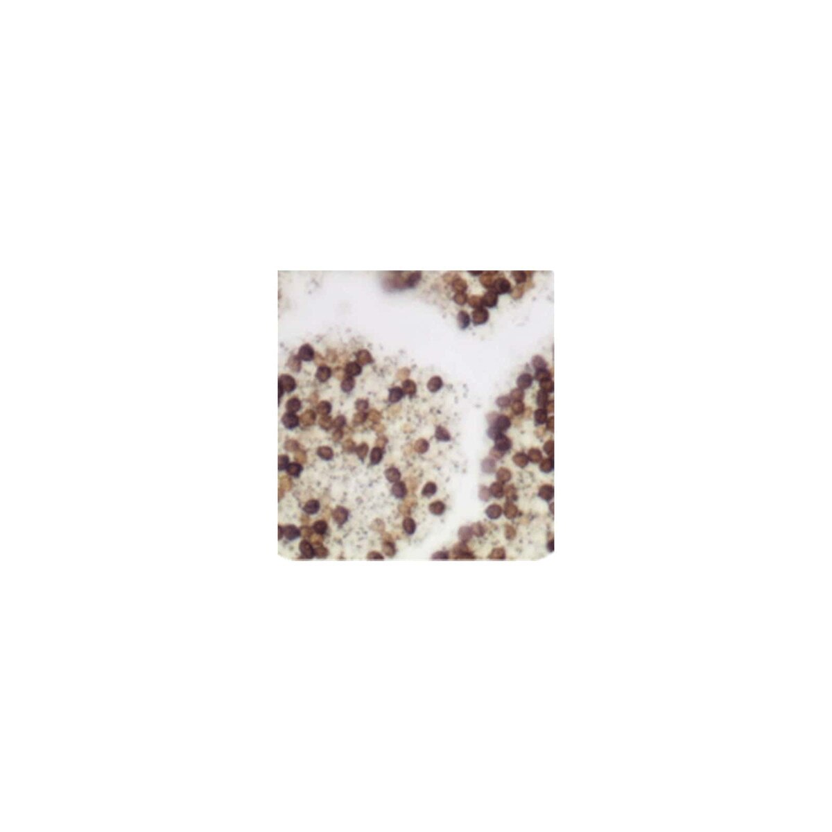 Warthin-Starry Stain Kit